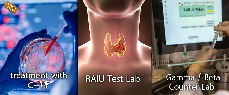 شمارشگر رادیونوکلئیدی ،پرو جذب تیروئید،درمان با C-14 copy