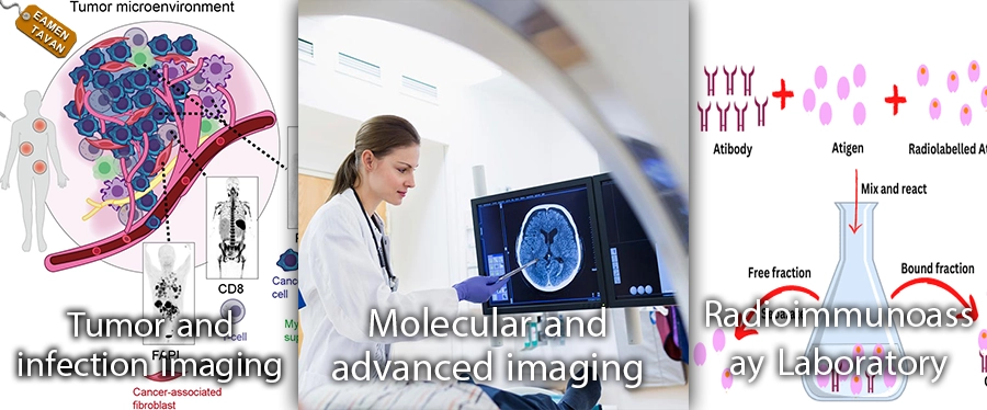 مولوکولی، تومور و عفونت،رادیوایمونواسی copy